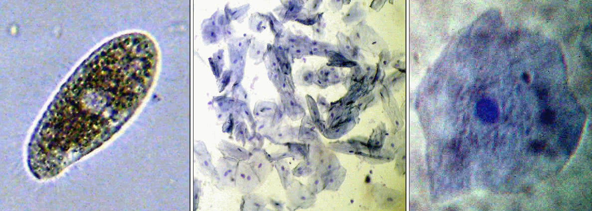 Mundschleimhaut Zellen