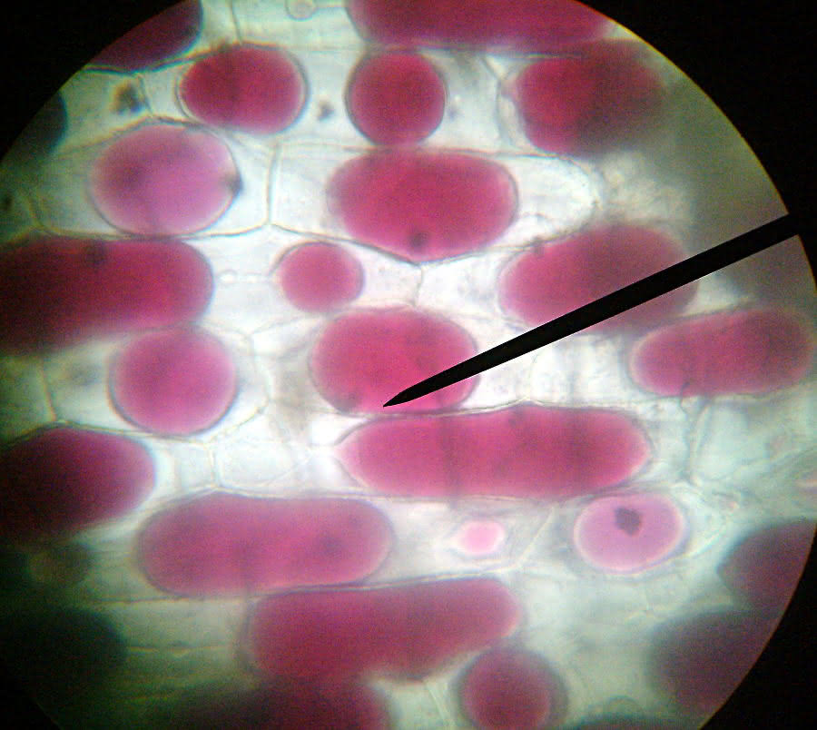 Zwiebelzellen, Plasmolyse
