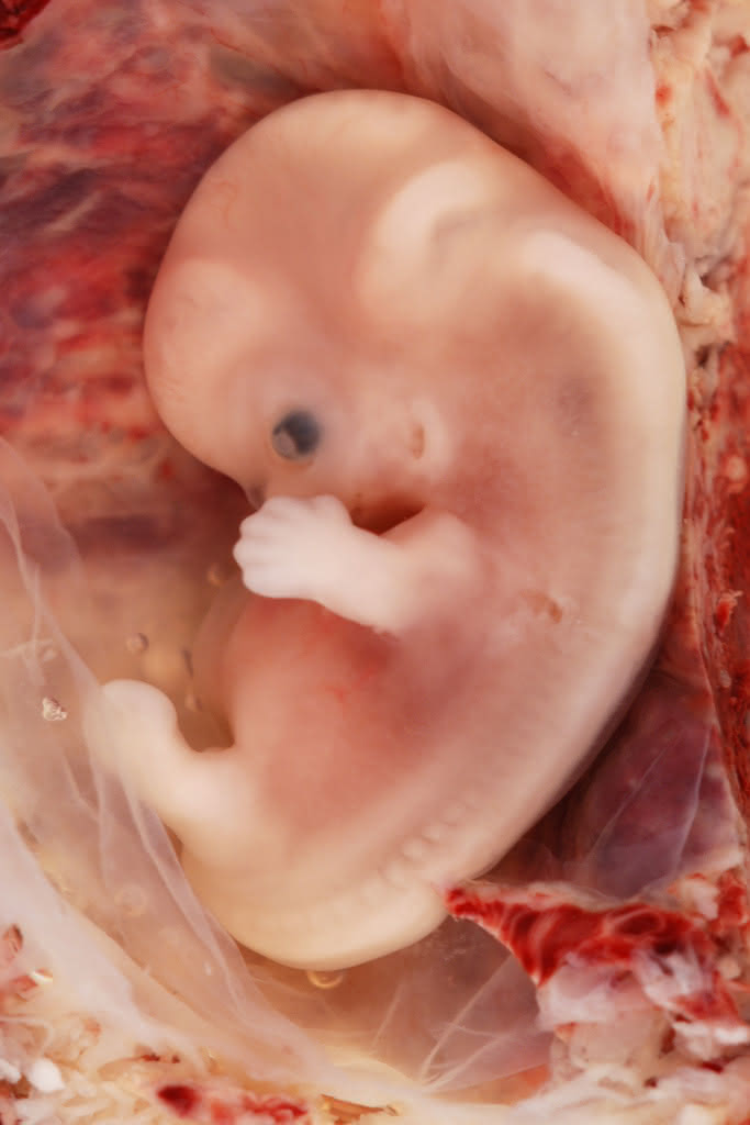 Embryo in der 9. Woche